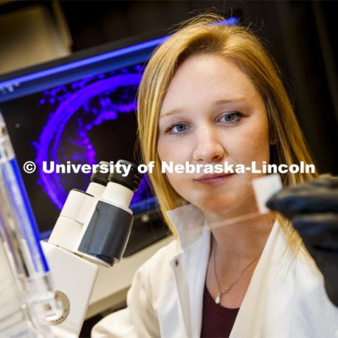 Morgan Schake examines a slide. She is a graduate student in the lab of Ryan Pedrigi, Assistant Professor in Department of Mechanical and Materials Engineering, College of Engineering. March 13, 2020. Photo by Craig Chandler / University Communication.